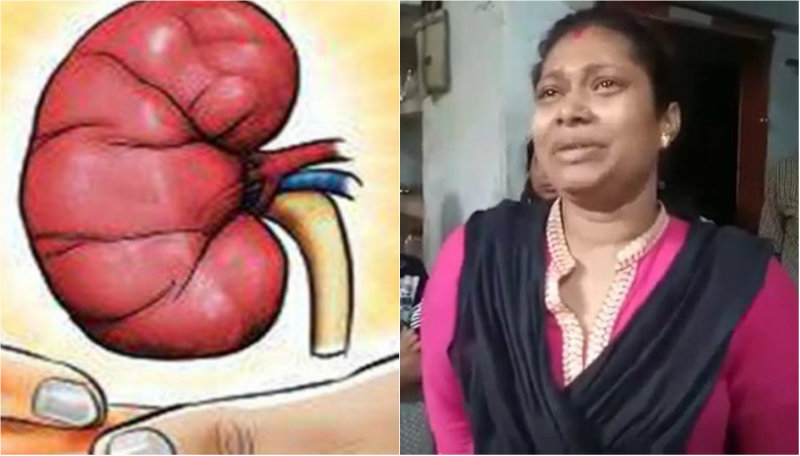 2 ಲಕ್ಷ ರೂ. ವರದಕ್ಷಿಣೆ ತರದಕ್ಕೆ ಪತ್ನಿಯ ಕಿಡ್ನಿಯನ್ನ ಮಾರಿದ ಪತಿ