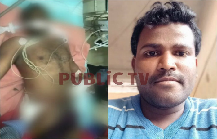 ಡಿಜೆ ಮ್ಯೂಸಿಕ್ ವಿಚಾರದಲ್ಲಿ 2 ಕೋಮುಗಳ ಮಧ್ಯೆ ಘರ್ಷಣೆ- ಬಿಡಿಸಲು ಹೋದ ಯುವಕ ದಾರುಣ ಸಾವು