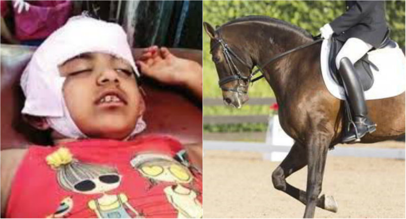 ಕುದುರೆ ಸವಾರಿ ವೇಳೆ ಬಿದ್ದು ಮೆದುಳಿಗೆ ಗಂಭೀರ ಗಾಯ- 7ರ ಬಾಲಕಿಯ ತಲೆಗೆ 8 ಸ್ಟಿಚ್!