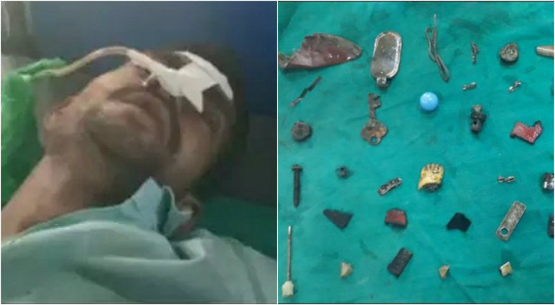 ಮದುವೆಯಾಗಲು ಮಾಂತ್ರಿಕನ ಮಾತು ಕೇಳಿ ಮೊಬೈಲ್ ಕೀ, ವೈರ್ ನುಂಗಿದ!