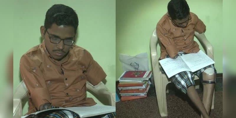 ಅಪಘಾತದಲ್ಲಿ ಎರಡು ಕೈ, ಕಾಲು ಕಳೆದುಕೊಂಡ್ರೂ ಎದೆಗುಂದದ ವಿದ್ಯಾರ್ಥಿ