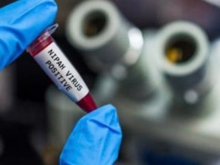 Nipah Virus