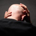 man bald