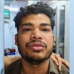 up man beaten, forced to drink poison by girlfriend, her associates