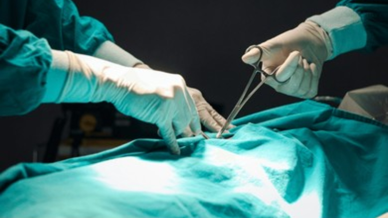Surgical instrument found in womans abdomen 5 years after surgery in Kerala inquiry launched 3