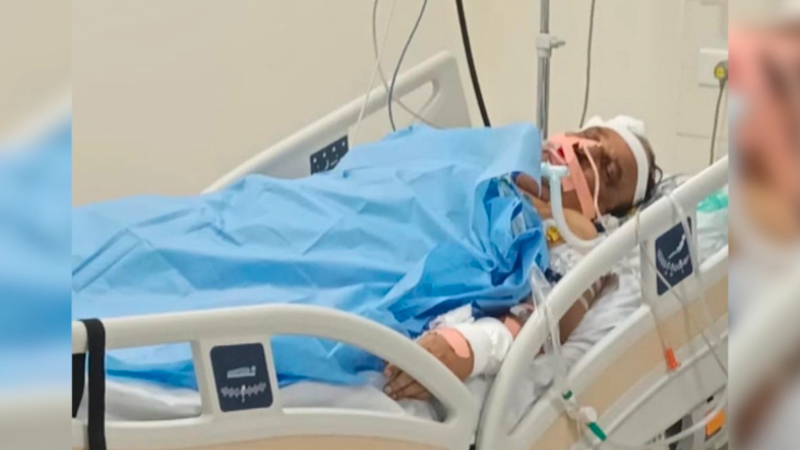 Minister D. Sudhakars health condition is critical 1