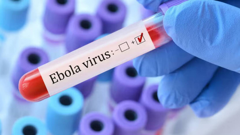 Ebola Virus
