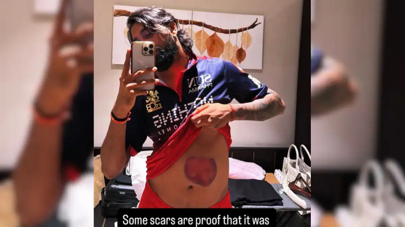 Krunal Pandya