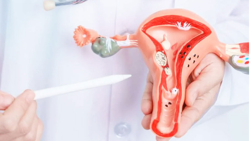 Ovary 2