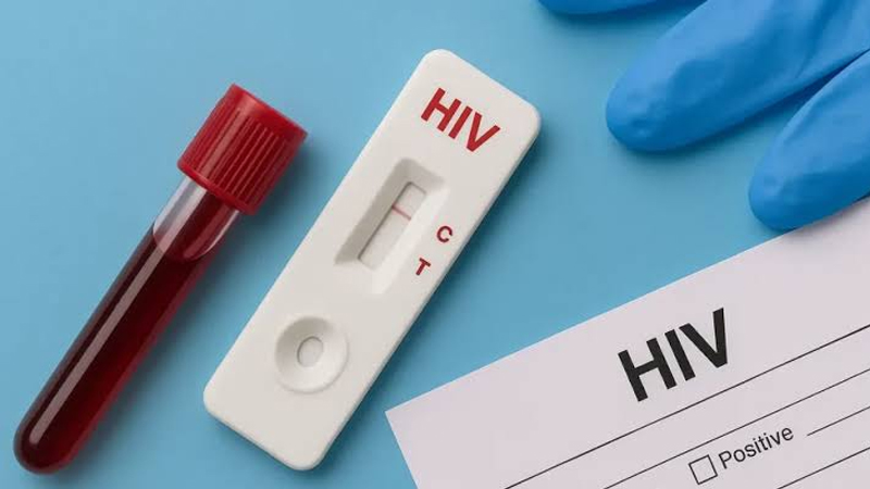 ರಾಜ್ಯದ ಕಾಲೇಜು ವಿದ್ಯಾರ್ಥಿಗಳಿಗೆ HIV ಪರೀಕ್ಷೆ ನಡೆಸಲು ಆರೋಗ್ಯ ಇಲಾಖೆ ನಿರ್ಧಾರ 10 HIV 2