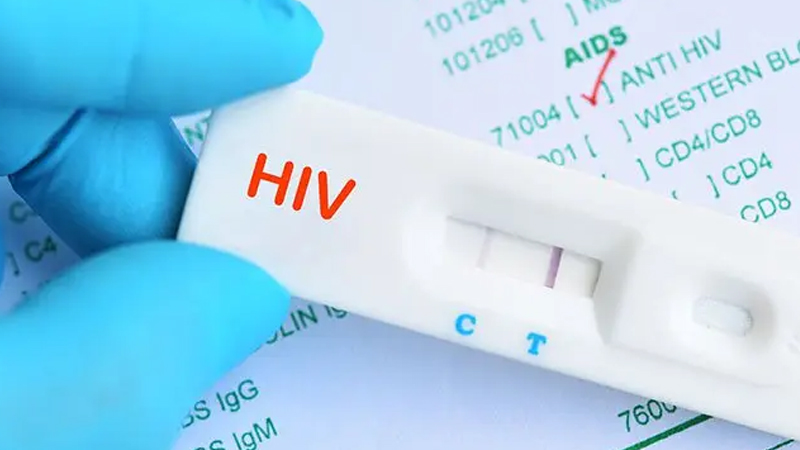 ರಾಜ್ಯದ ಕಾಲೇಜು ವಿದ್ಯಾರ್ಥಿಗಳಿಗೆ HIV ಪರೀಕ್ಷೆ ನಡೆಸಲು ಆರೋಗ್ಯ ಇಲಾಖೆ ನಿರ್ಧಾರ 11 HIV 3