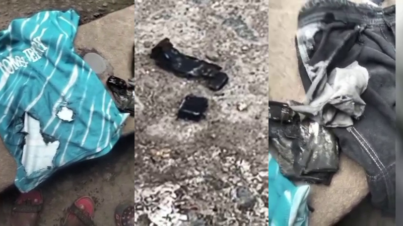 Bagalkote Power Bank Bursts into Flames in Youths Pocket Near Jamkhandi Bus Stand