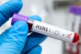 H1N1 Swine Flu