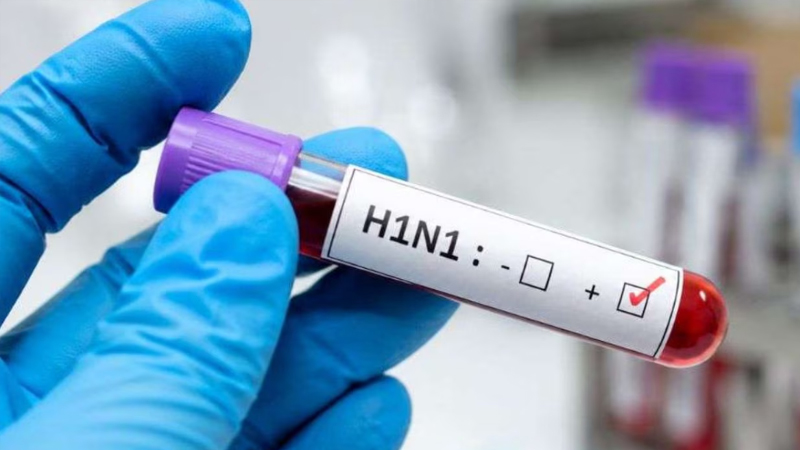 H1N1 Swine Flu