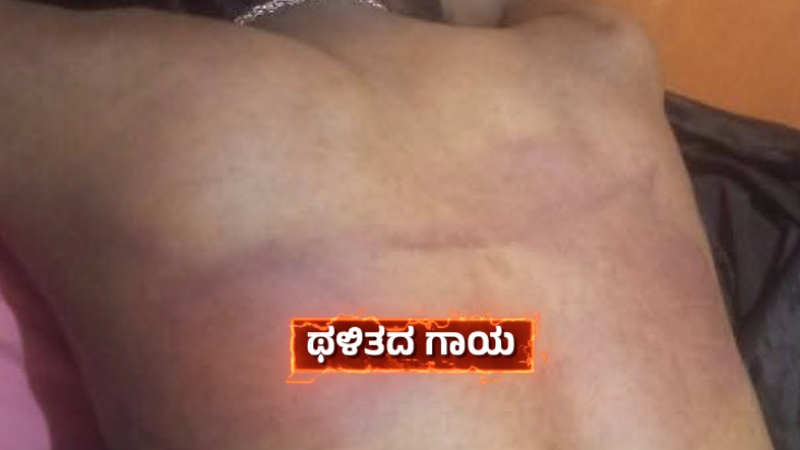 Custodial Torture Row Photos of Inspector Dhananjays Past Brutality Go Viral Amid Growing Outrage in T Narasipura 1