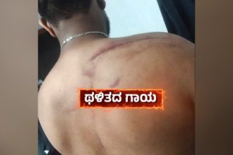 Custodial Torture Row Photos of Inspector Dhananjays Past Brutality Go Viral Amid Growing Outrage in T Narasipura 2