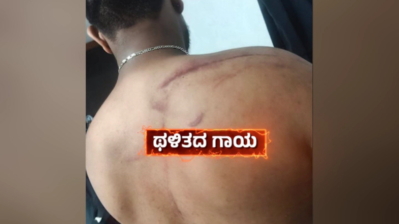 Custodial Torture Row Photos of Inspector Dhananjays Past Brutality Go Viral Amid Growing Outrage in T Narasipura 2