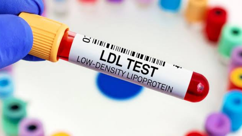 LDL