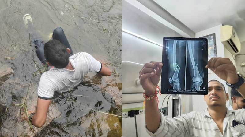 Man jumps from 30 feet into dam for reels fractures both legs in uttar pradesh jhansi